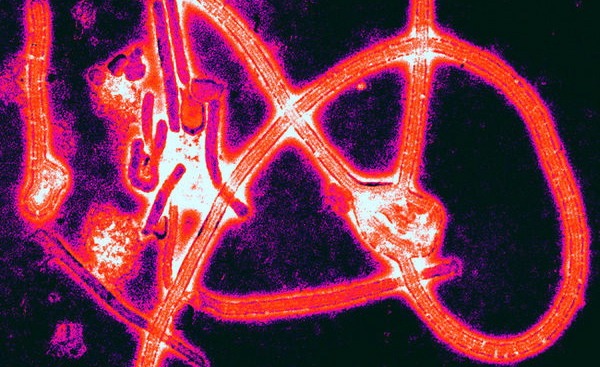 Color-enhanced electron micrograph of Ebola virus particles. (Thomas W. Geisbert, Boston University School of Medicine, via Wikimedia Commons)
